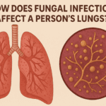 How Does the Presence of Fungal Infection Affect a Person’s Lungs?