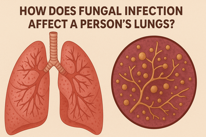 How does fungal infection affect person's lungs?