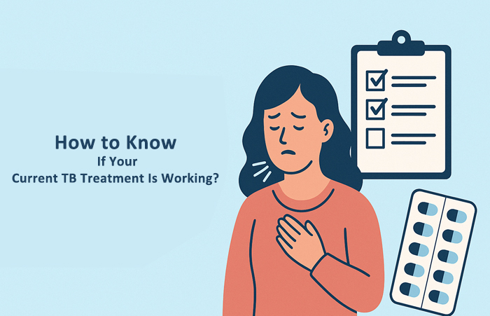 How to Know If Your Current TB Treatment Is Working